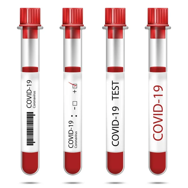 COVID-19 için kan örneği içeren test tüpü koleksiyonu beyaz arka planda izole edildi.
