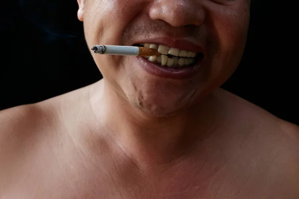 Sigara tutan bir adam. Nikotin dişleri ve diş etlerini sağlıklı bir şekilde yok eder. bu etkisi Sarı leke, Diş çürümesi ve Kötü nefes olun. dünya no tobacoo gün.