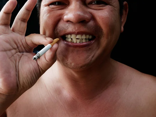 Homem Com Cigarro Nicotina Destruir Dentes Gengiva Saudável Ele Faz — Fotografia de Stock