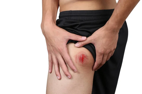 Bruised Wound Injury Skin Butt Skin Bum Asian Young Boy — Stock Photo, Image