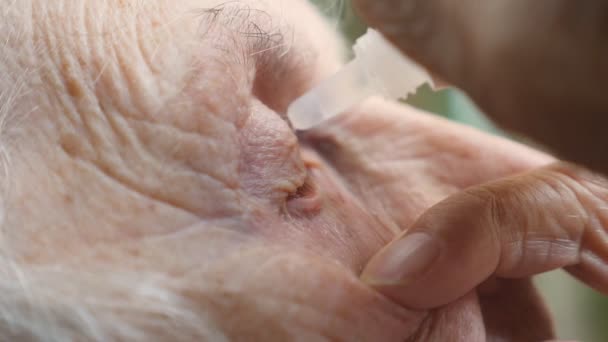 Perfil da velha mulher pingando gotas médicas em seu olho. Retrato de avó com infecção e inflamação dos olhos. Conceito de saúde e medicina. Vista lateral Fechar em câmera lenta — Vídeo de Stock