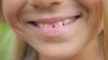 Sarışın saçlı gülümseyen ve beyaz dişleri gösteren küçük sevimli kız ağzını kapatın. Neşeli küçük çocuk neşeli bir gülümseme ile kameraya gülüyor. Mutlu çocuk yüzünde ayrıntılı görünüm. Ön görünüm Yavaş hareket