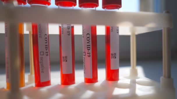 Тестовые трубки с образцами крови для коронавируса в стойке в лаборатории или больнице. Лаборатория тестирует кровь пациентов на COVID-19. Концепция научных исследований и обеспечения безопасности жизни от пандемии коронного вируса — стоковое видео
