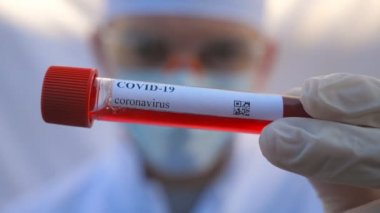 Koruyucu eldivenli bir doktorun eli COVID-19 virüsüne kan örneği test ediyor. Coronavirus 'a kan örneği taşıyan test tüpünü tutan sıhhiye kolu. Salgından korunan sağlık ve güvenlik kavramı. Kapat.