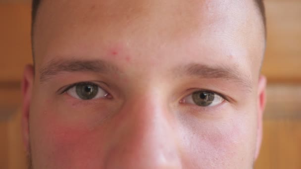 Feche os olhos verdes de cara olhando e piscando com uma visão ao ar livre confiante. Retrato do rosto masculino olhando para a câmera em fundo embaçado. Expressão facial do homem infeliz — Vídeo de Stock