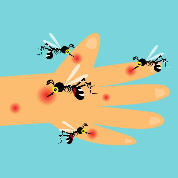 蚊刺され手の概念 — ストックベクタ