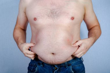 Overweight shirtless caucasian man holding his belly fat clipart