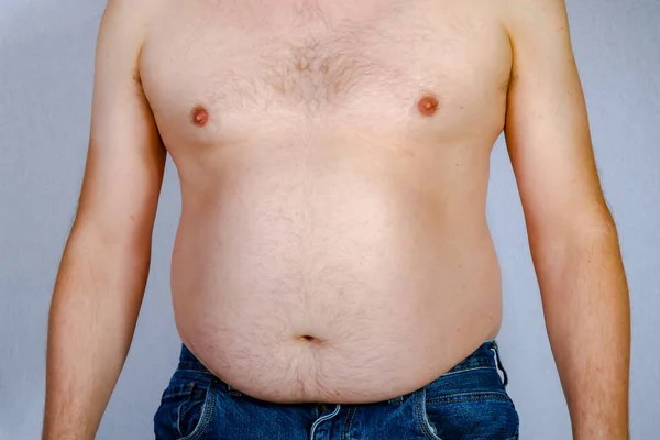 Sovrappeso Uomo Caucasico Senza Maglietta Piedi Visto Dalla Parte Anteriore — Foto Stock