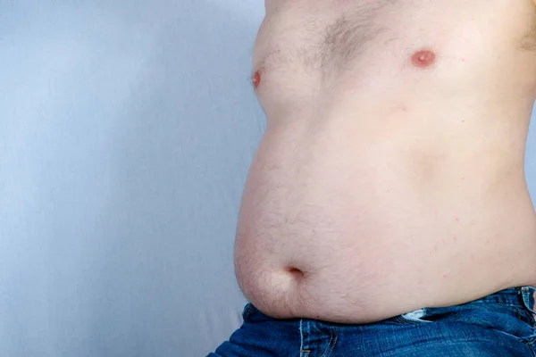 Sovrappeso Uomo Caucasico Senza Camicia Seduto — Foto Stock
