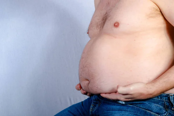 Överviktig Shirtless Kaukasiska Man Håller Hans Magen Fett — Stockfoto