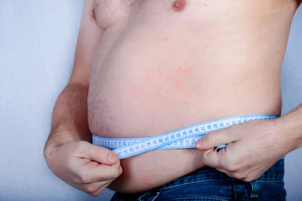 Sobrepeso Sem Camisa Caucasiano Homem Medindo Seu Estômago — Fotografia de Stock