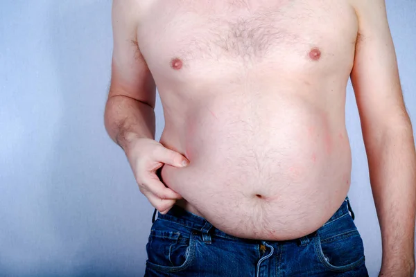 Sobrepeso Sem Camisa Caucasiano Homem Segurando Sua Gordura Barriga — Fotografia de Stock