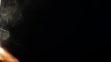 Lens üzerindeki ışığın etkisi..