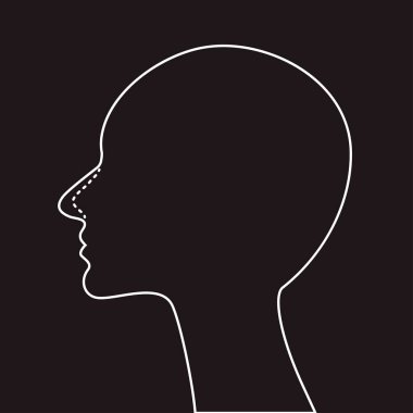 Rhinoplasty, nose plastic surgery, aesthetic medicine Vector illustration clipart