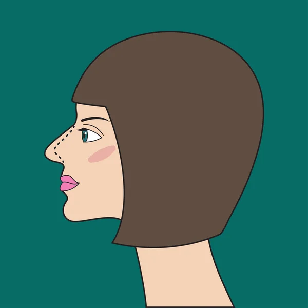 Rhinoplastie Chirurgie Esthétique Nez Illustration Vectorielle — Image vectorielle