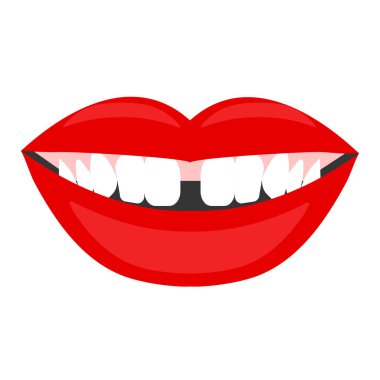 Diastema, diş, ağız gülüyor kadın arasındaki boşluğu. Vektör çizim