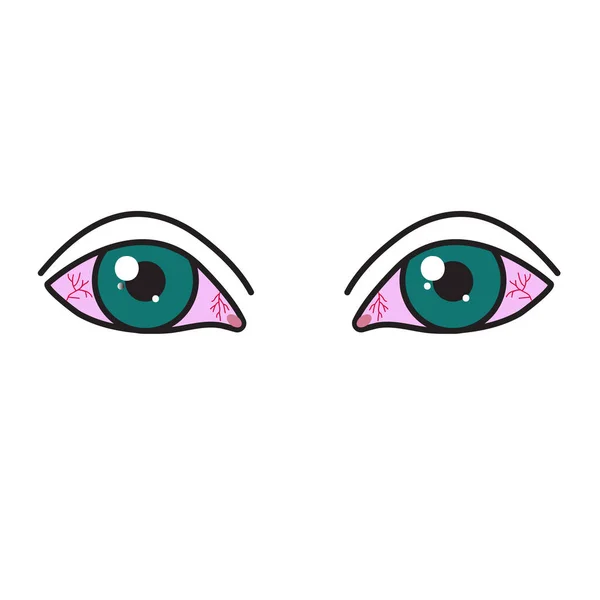 Ojos enrojecidos inflamados — Vector de stock