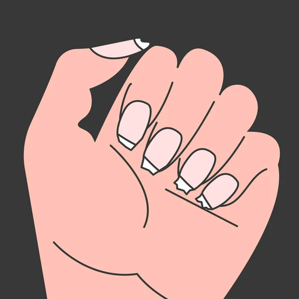 Brittle Nails Female Hand Thin Broken Nails Vector Illustration — Stock Vector
