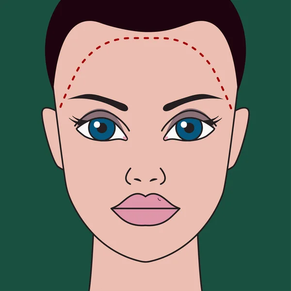 Correction de la perte de cheveux — Image vectorielle