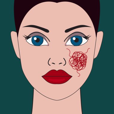 woman with dilated vessels on face clipart