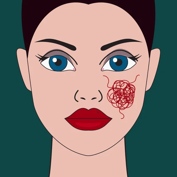 Mujer con vasos dilatados en la cara — Archivo Imágenes Vectoriales