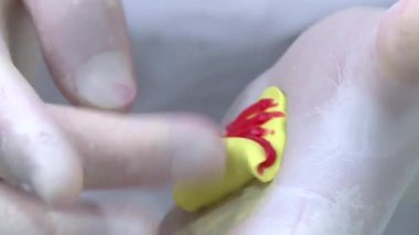 Diş hekimi diş izini alır. İmplantlarda işe yarıyor. Parantez değiştir