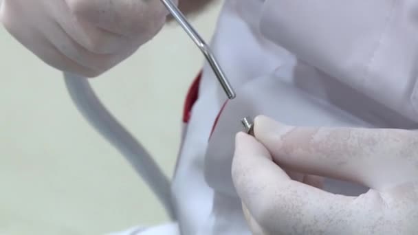 Tandarts Neemt Een Afdruk Van Tanden Werken Implantaten Wisselbeugels — Stockvideo