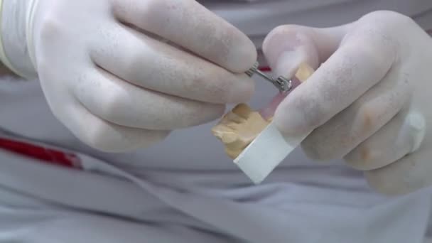 Дантист Делает Отпечатки Зубов Работает Имплантатах Изменить Скобки — стоковое видео