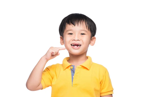 Utraconych Zębów Mlecznych Chłopiec Azjatyckich Zbliżenie — Zdjęcie stockowe