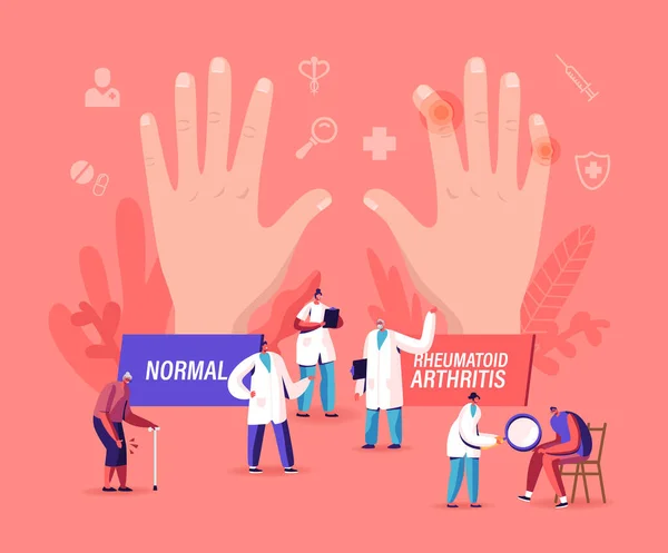 Konzept der rheumatoiden Arthritis. Kleine Arztfiguren untersuchen riesige Hand mit Gelenkerkrankungen und Pathologie, Armkrankheit — Stockvektor