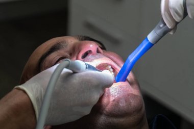 Diş kontrolü sırasında dişlerini muayene ettiren adamın yakın çekimi