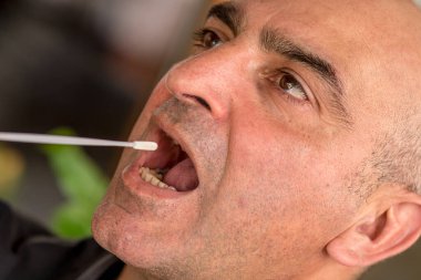 Uzun bir çubuk kullanılarak Coronavirus hastalığı (COVID-19) testi yapılıyor