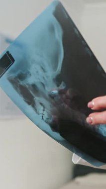 Close-up view of a professional doctors hand holding and analyzing an X-ray film showing human skull and neck bones. Ideal for medical, healthcare, and diagnostic technology concepts.