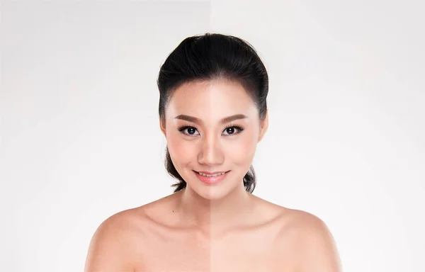 美丽的亚洲年轻女子在白色背景 美丽的概念 修饰前后 脸部分为两部分 不良状况良好的皮肤状况 — 图库照片
