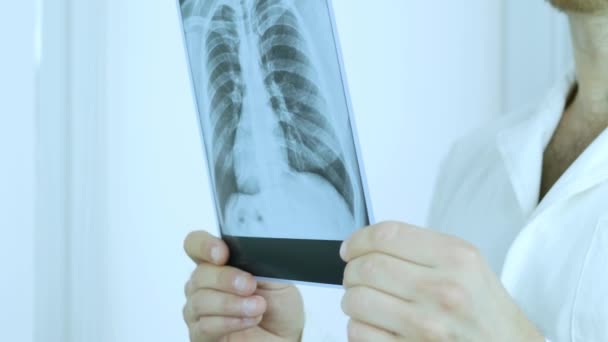 Médico Examina Raio Dos Pulmões Dos Pacientes Pneumonia Foto Nas — Vídeo de Stock