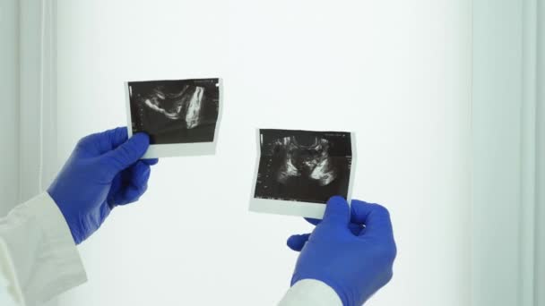 Médico Observa Radiografía Próstata Humana Examen Cerca Análisis Imagen Glándula — Vídeo de stock