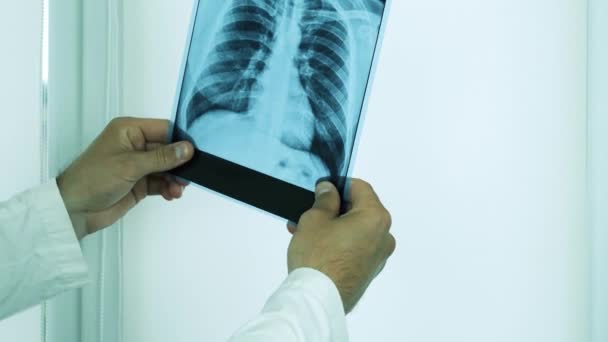 Médico Observa Radiografía Los Pulmones Señala Con Dedo Las Áreas — Vídeos de Stock
