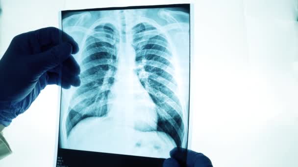 Röntgen Der Lungen Das Licht Betrachten Der Arzt Untersucht Sorgfältig — Stockvideo