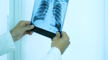 Doktor akciğerlerin röntgenine bakar, parmağını sorunlu bölgelere doğrultur, bir şey söyler, akciğerlerin zatürreesini teşhis eder. Yakın plan.