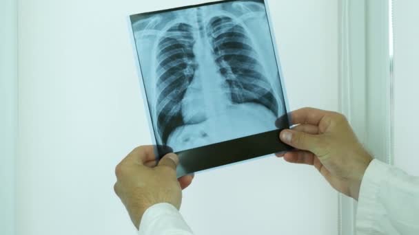 医生手拿医用手套 手里拿着一个人的X光照片 检查肺部的图像 对病人得出结论 — 图库视频影像