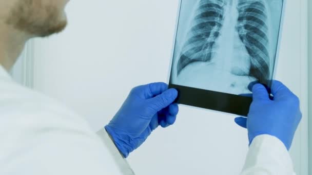 Tıbbi Enstitüdeki Bir Doktorun Ellerindeki Akciğerlerin Röntgeni Bir Tıp Çalışanı — Stok video