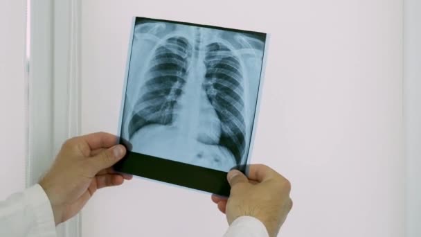 Ένας Ιατρός Ένα Νοσοκομείο Εξετάζει Και Εξετάζει Μια Ακτινογραφία Των — Αρχείο Βίντεο