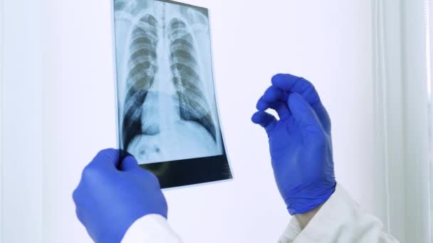 Radiographie Des Poumons Humains Dans Les Mains Médecin Homme Travaillant — Video