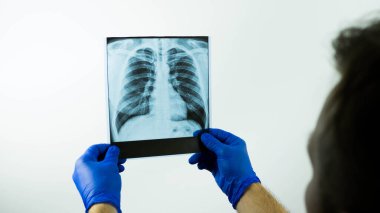 Doktor, beyaz arka planda bir resmin akciğerlerinin röntgenini çeker. Bir tıp çalışanı elinde bir röntgen tutar ve hastalığı yakından inceler.