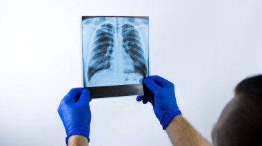 Doktorun elindeki akciğerlerin röntgeni, tıbbi uzman hastaya teşhis koyuyor, resimdeki akciğerleri inceliyor, ofisteki doktor da akciğerlerin analizini yapıyor..