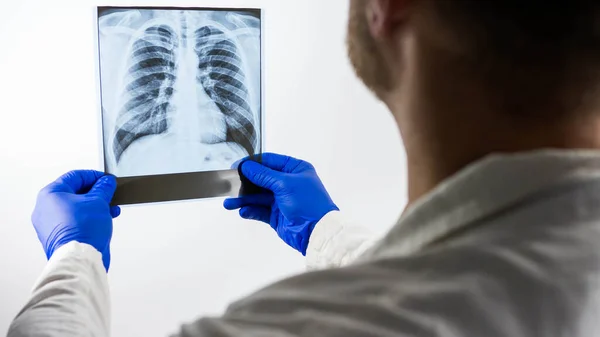 X-ray of the lungs in the hands of a doctor,a medical worker carefully examines an X-ray of a person\'s lungs, pneumnoia and pulmonary edema, close-up,on a white background