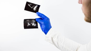 Doktor elinde prostatın röntgenini tutuyor, beyaz arka planda, tıbbi uzman prostat bezinin röntgenlerini inceliyor.