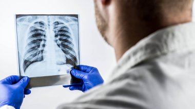 Sağlıklı bir insanın akciğerlerinin röntgeni beyaz bir arka planda bir doktorun elinde. Hastalığı incelemek için akciğerlerin bir fotoğrafı, teşhis koymak için. Ofisteki bir tıp çalışanı akciğer yolunu inceliyor.