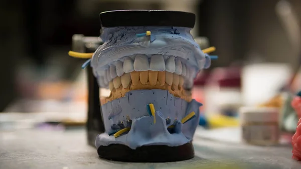 Protez Diş Telleri Için Ortodontik Insan Çenesi Kalıbı Sıvalı Diş — Stok fotoğraf