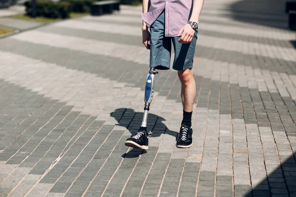 Handicap Jongeman Met Voet Prothese Wandelingen Langs Straat — Stockfoto